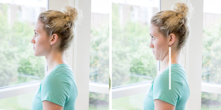 chin tucks for neck pain